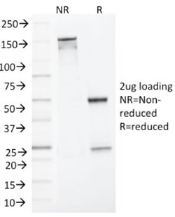 MLH1 Mouse anti-Human, Clone: MLH1/1324, Novus Biologicals:Antibodies:Primary